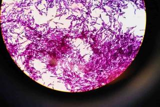 bacille de thuringe - bacillus thuringiensis